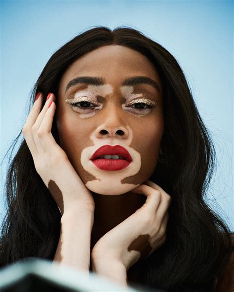 winnie harlow with makeup covering